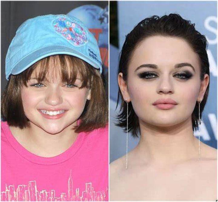 Jaime King Plastic Surgery Before and After